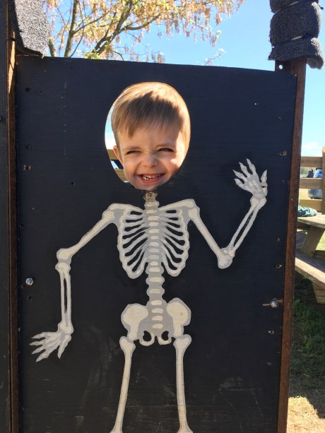 Making my best SKELLY FACE