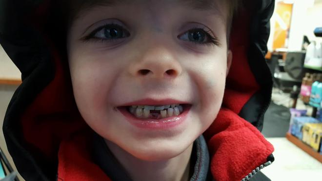 Notice anything missing? :)